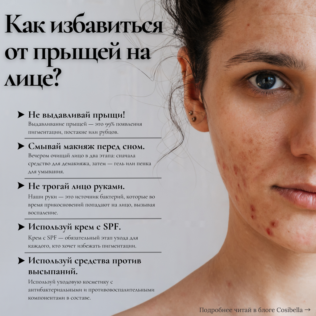 Инфографика: как избавиться от прыщей на лице?