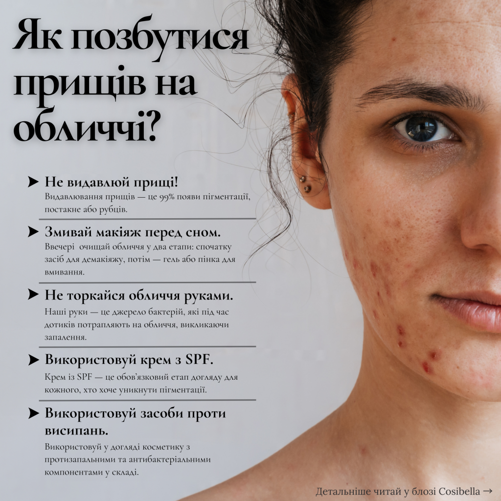 Інфографіка, як позбутися прищів на обличчі?