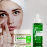 Акне на обличчі: яку косметику для домашнього догляду рекомендує косметолог?