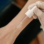 Аллергический тест — инструкция