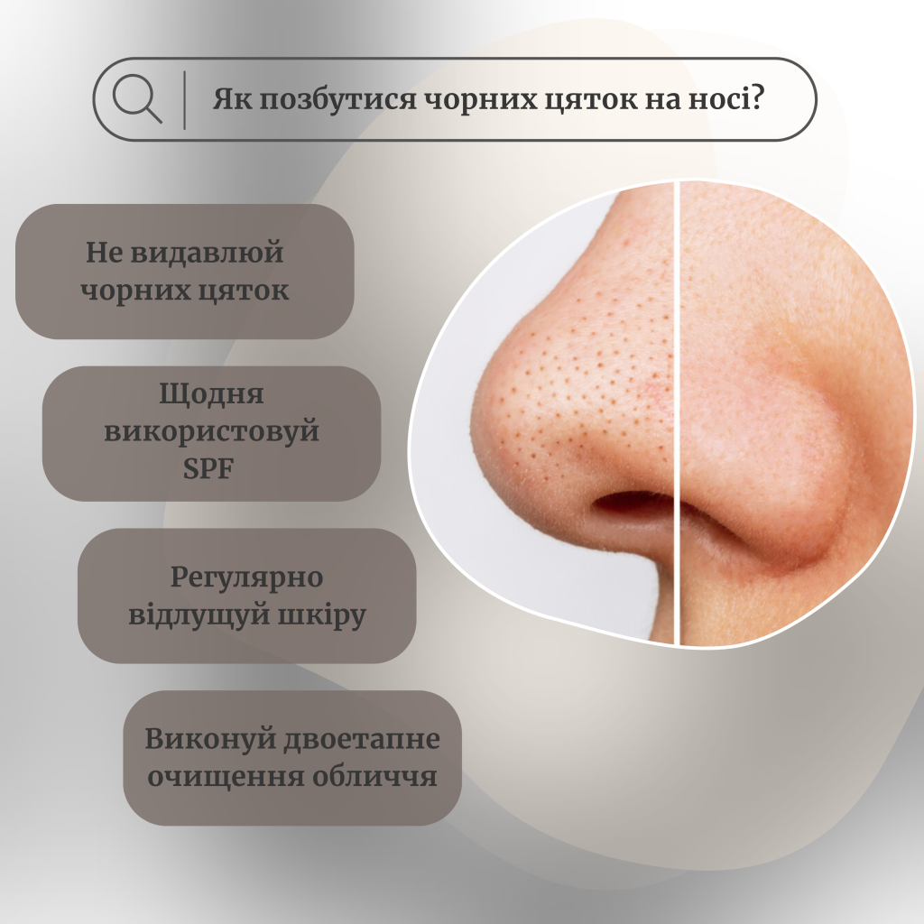 Як позбутися чорних цяток на носі?
