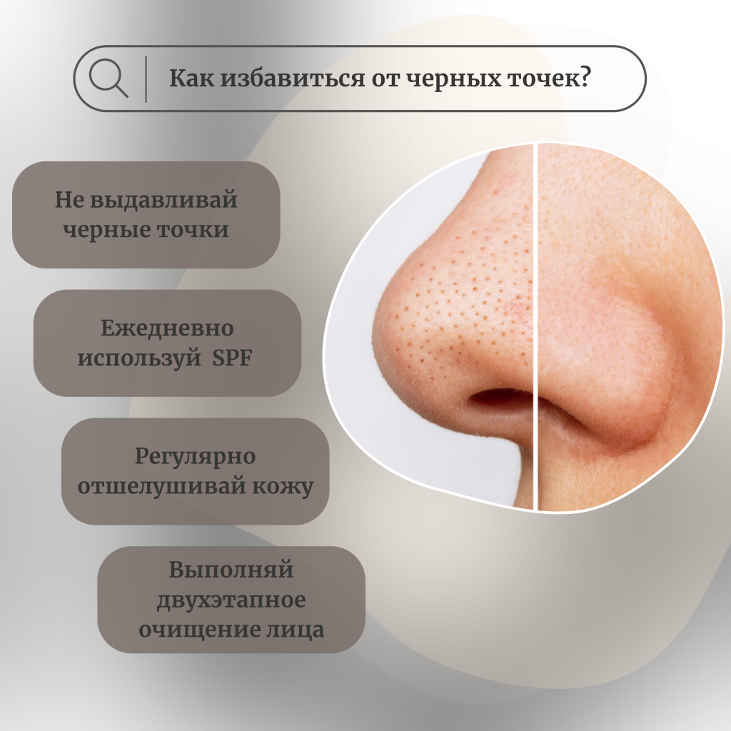 Как избавиться от черных точек?