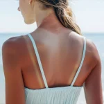 Сонячні опіки: як заспокоїти шкіру та зняти почервоніння? — поради косметолога