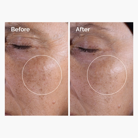 The Ordinary - Glycolic Acid 7% Exfoliating Toner - Отшелушивающий тоник с гликолевой кислотой 7% - 100ml