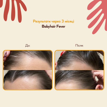 HairTry - Babyhair Fever - Разогревающий лосьон для роста волос - 200ml