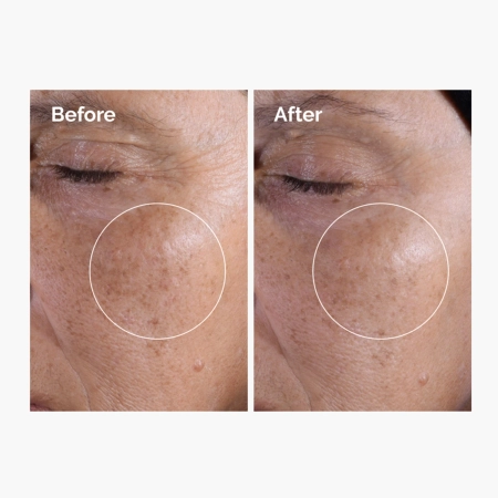 The Ordinary - Glycolic Acid 7% Exfoliating Toner - Отшелушивающий тоник с 7% гликолевой кислотой - 240ml