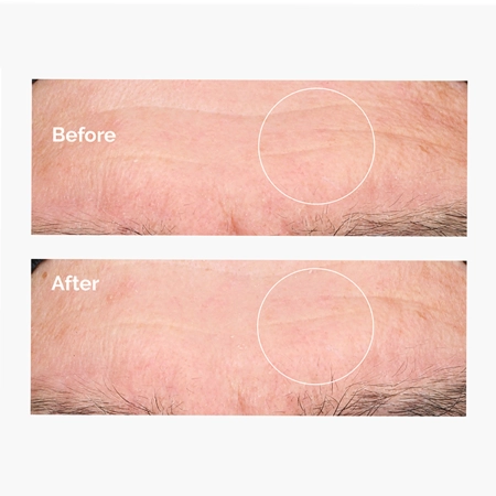 The Ordinary - Hyaluronic Acid 2% + B5 - Зволожувальна сироватка з гіалуроновою кислотою 2% та вітаміном B5 - 60ml