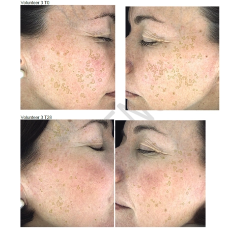 Nerds. - Hyperpigmentation Serum - 2% Alpha Arbutin + 1% Kojic Acid - Сыворотка против пигментации - 30ml