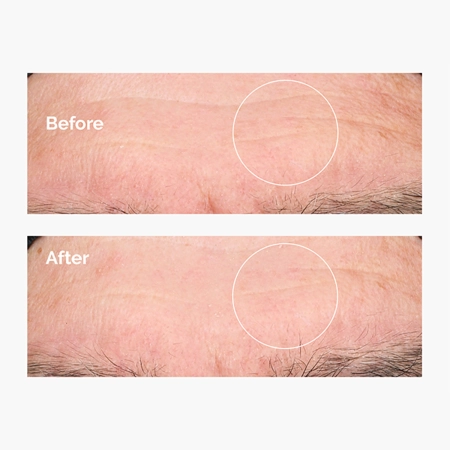 The Ordinary - Hyaluronic Acid 2% + B5 - Зволожувальна сироватка з гіалуроновою кислотою 2% та вітаміном B5 - 30ml