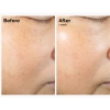 The Ordinary - Rice Lipids + Ectoin Microemulsion - Микроэмульсия с рисовыми липидами и эктоином - 120ml